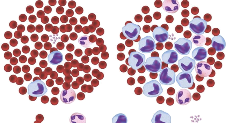 BLOOD CANCER DETECTION AI PROJECT